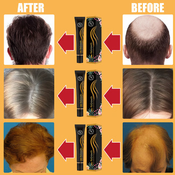 Regrowth Organic Hair Serum Roller